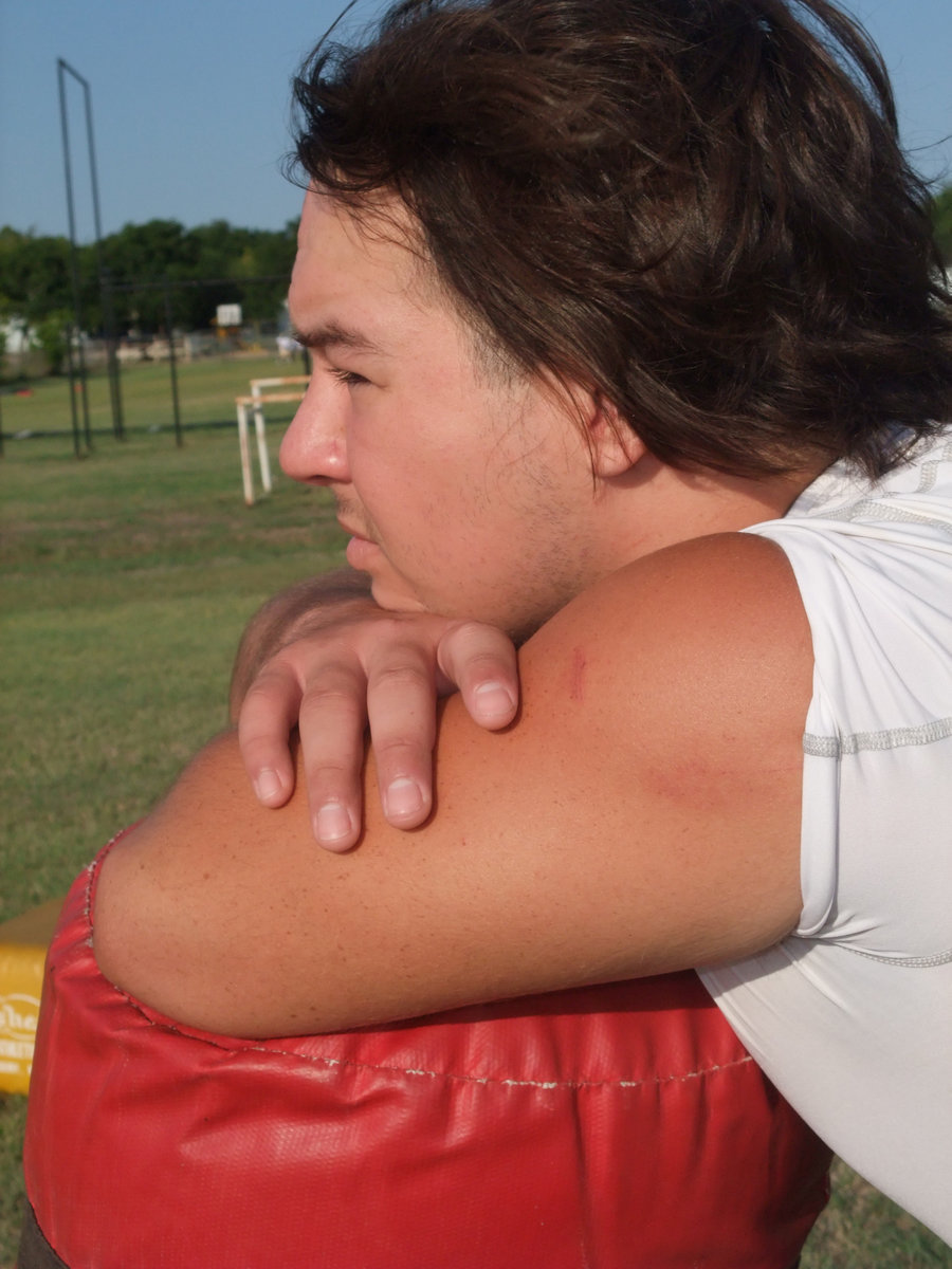 Image: Injury, no knee-slapper