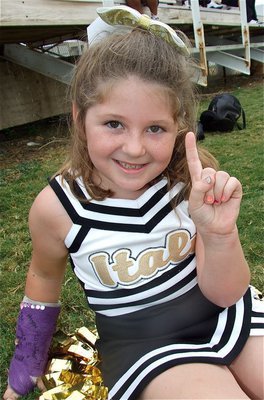 Image: Kammie Magness — Kammie still has one good hand.